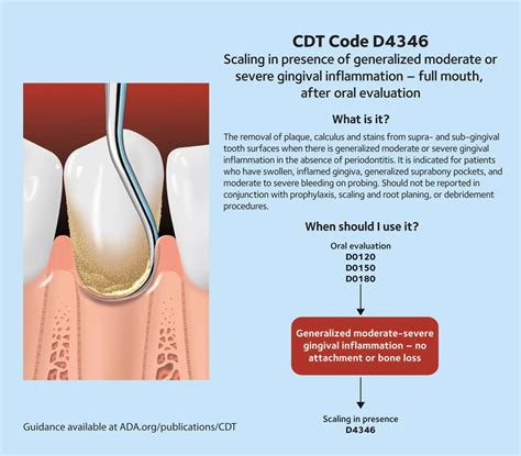 Understanding ADA Code 4346 and ADA Code 4910 in Dental Co.